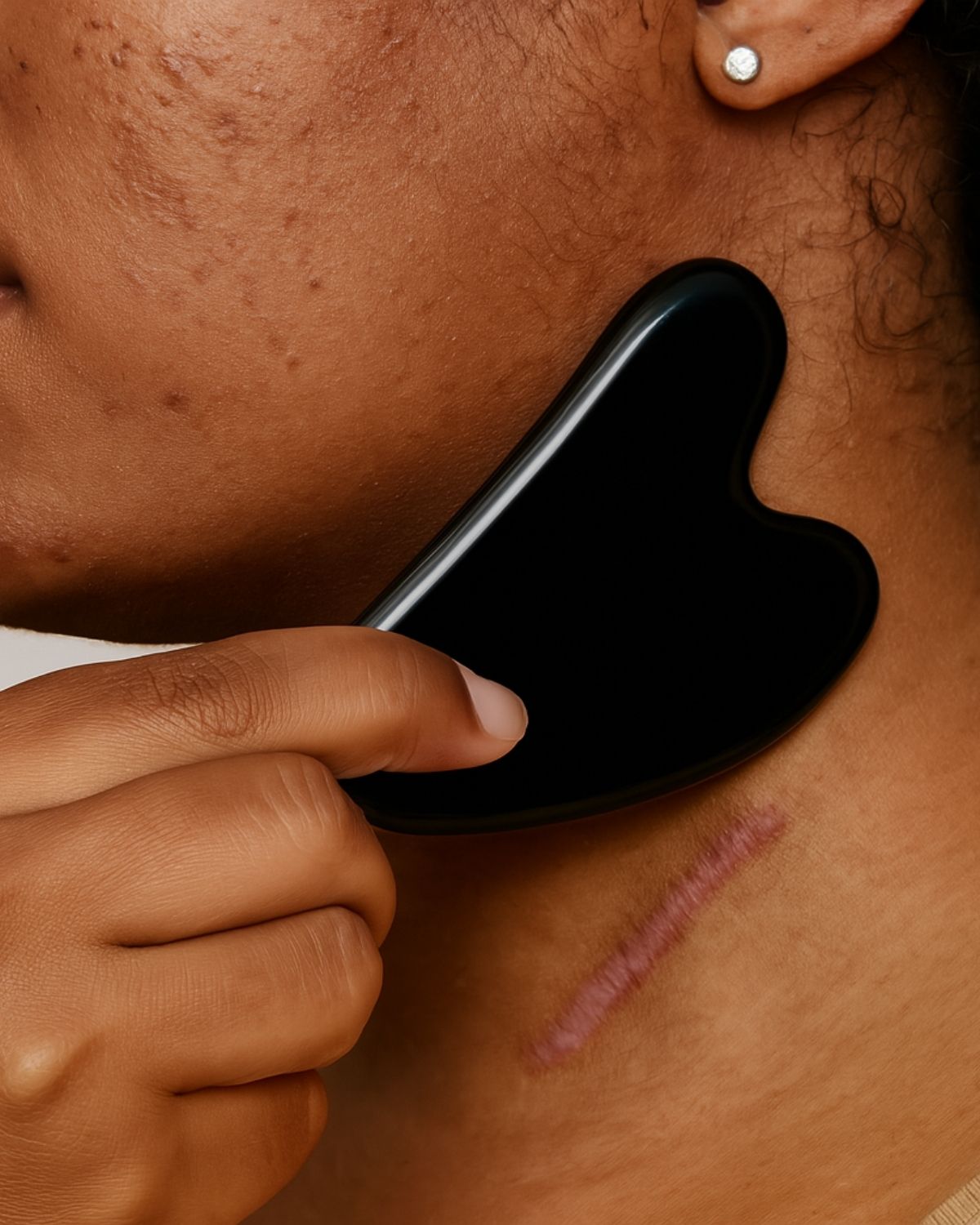 Gua Sha - Massage Stone Motivo Scar Care