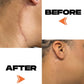 SCAR CREAM - 15ML Motivo Scar Care