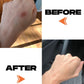 SCAR SERUM - 10ML Motivo Scar Care