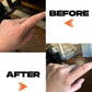 SCAR TAPE - 4PCS 6.5″ x 2″ Motivo Scar Care